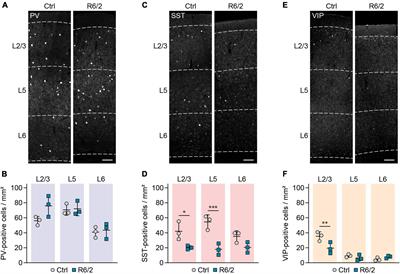 Distinct histological alterations of cortical interneuron types in mouse models of Huntington’s disease